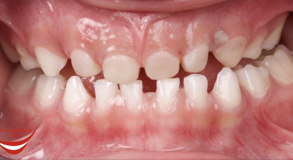 After treatment smile