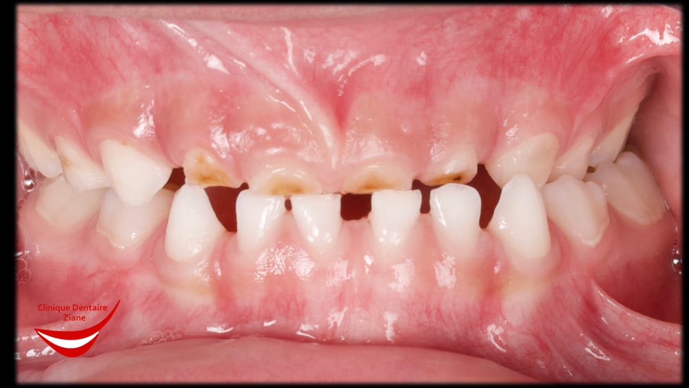 Before treatment smile