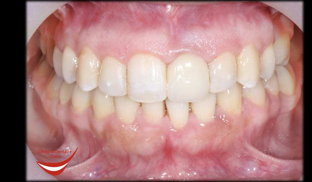 After treatment smile