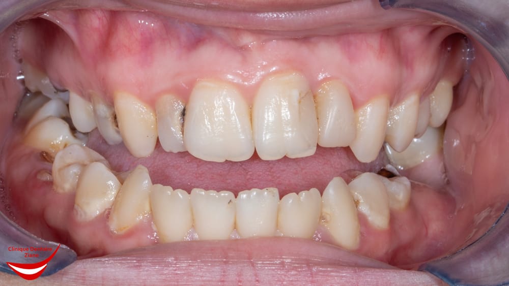 Before treatment smile