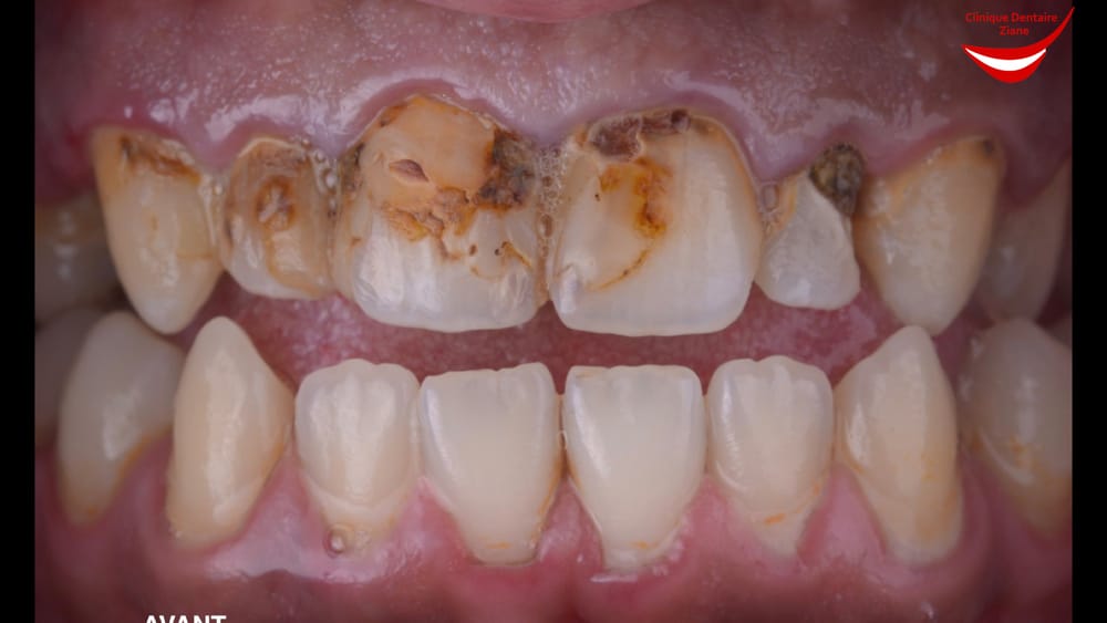 Before treatment smile