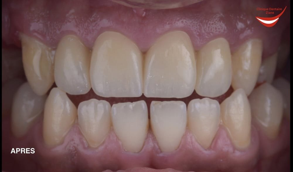 After treatment smile