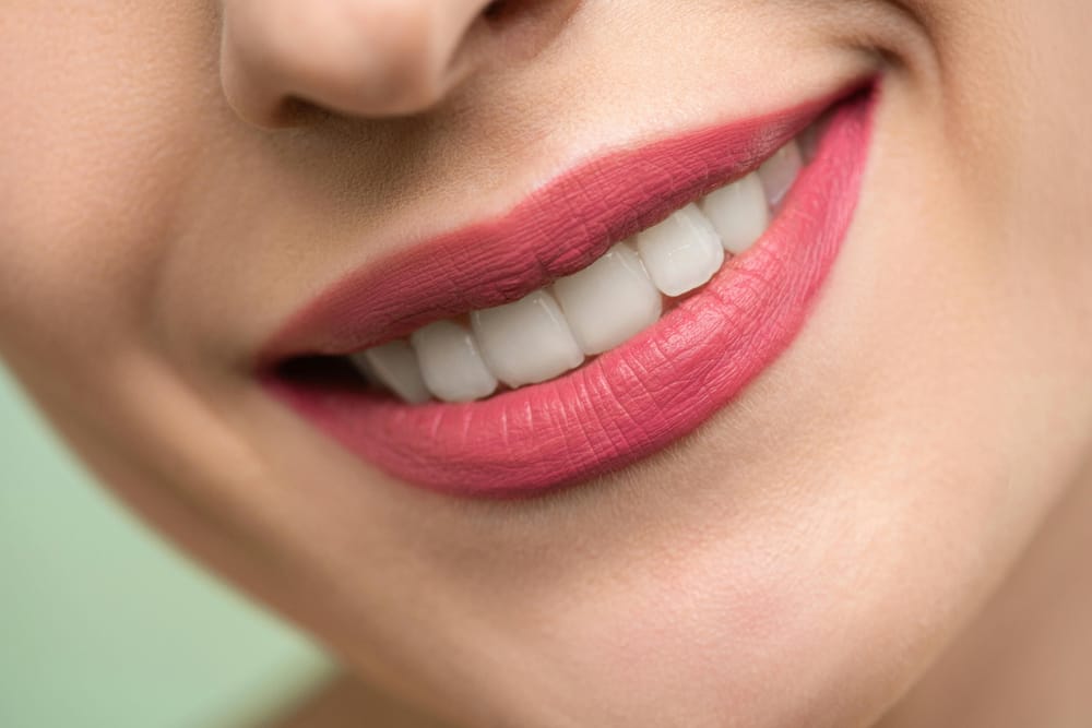 Hollywood Smile